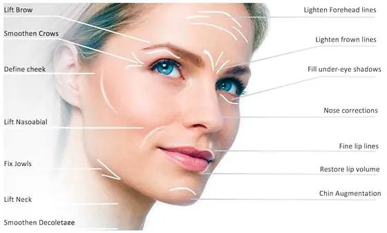 Surgical / Non-Surgical Face Lift & Thread Lift